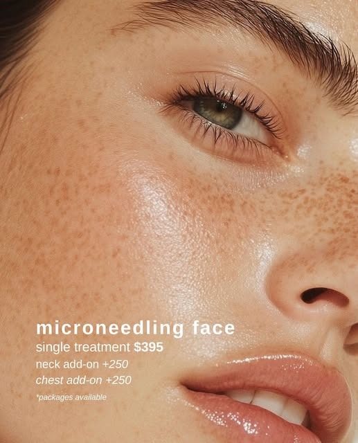Microneedling for the face